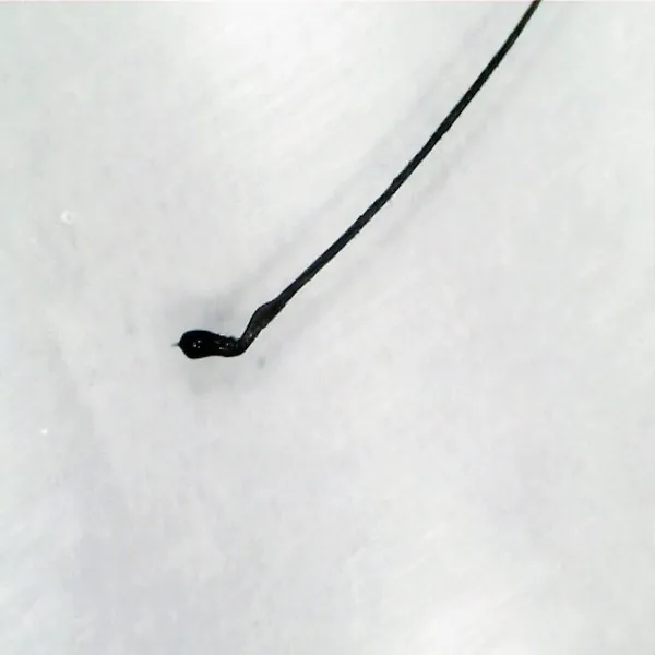 Imagem ampliada de fios de cabelo e couro cabeludo em exame de tricoscopia