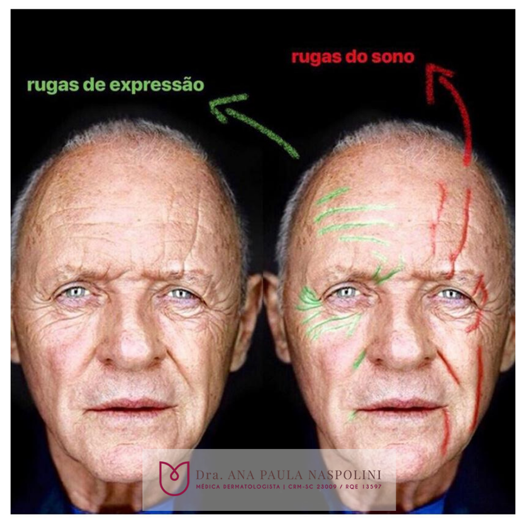 Expressão facial dormindo